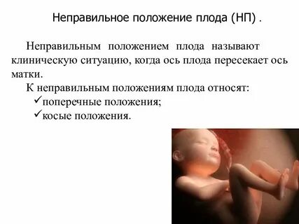 33 неделя положение плода