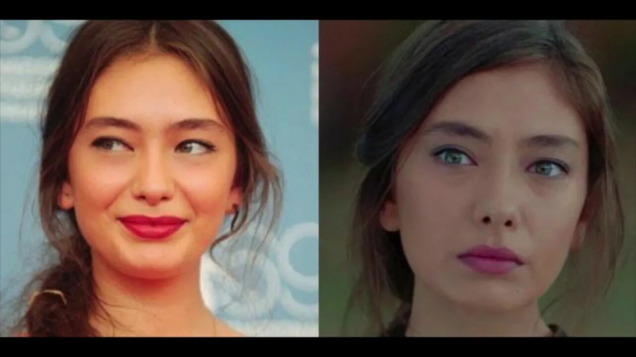 Неслихан атагюль до и после пластики. Неслихан атагюль пластика. Неслихан атагюль без макияжа. Неслихан атагюль до и после пластики. Неслихан атагюль 2022.