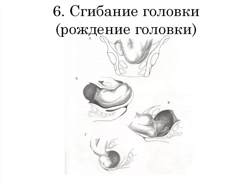 Этапы открывания головки. Процесс раскрытия головки.