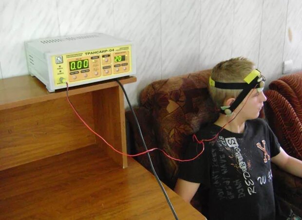 Транскраниальная электрополяризация. Прибор полярис для микрополяризации. Транскраниальная электростимуляция головного мозга. Метод микрополяризации. Поляризация мозга.