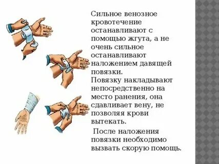 Наложение повязок жгута шин