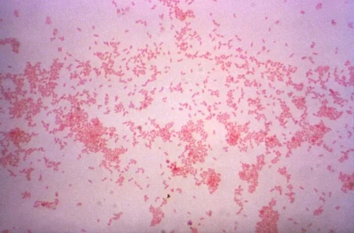 Brucella spp. Бруцелла суис. brucella melitensis микробиология. бруцеллы микроскопия. brucella abortus окраска.