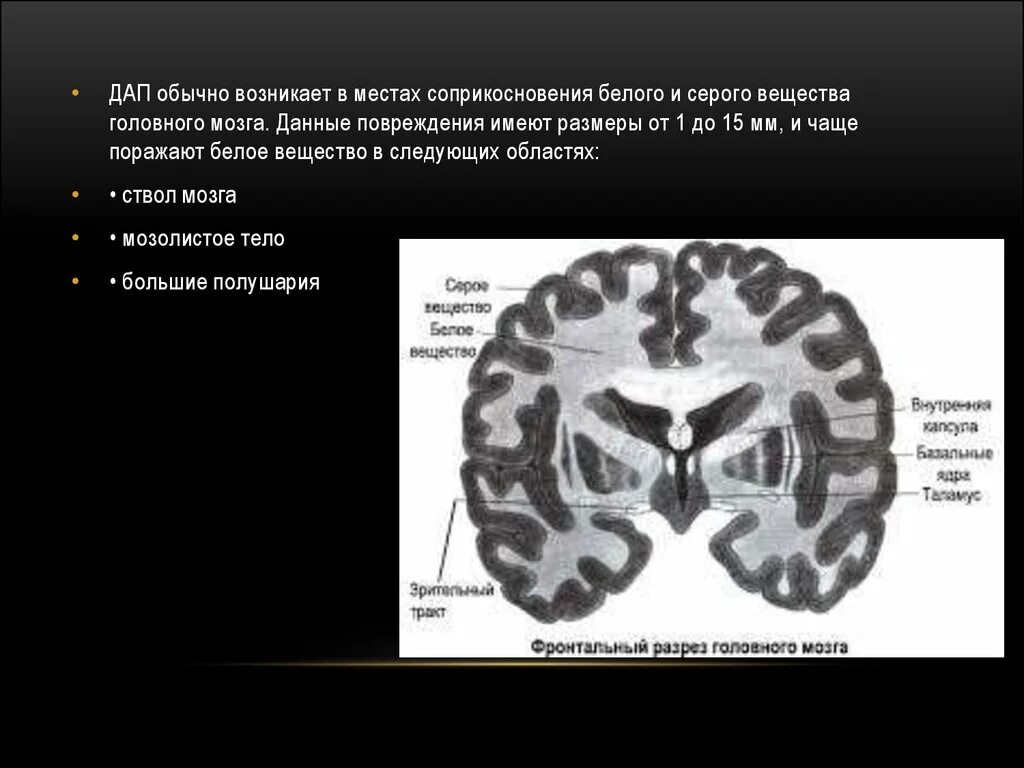 Серое вещество головного мозга. Серое и белое вещество головного мозга. Серое вещество и белое вещество. Серое вещество и белое вещество головного мозга. Поражение белого вещества мозга