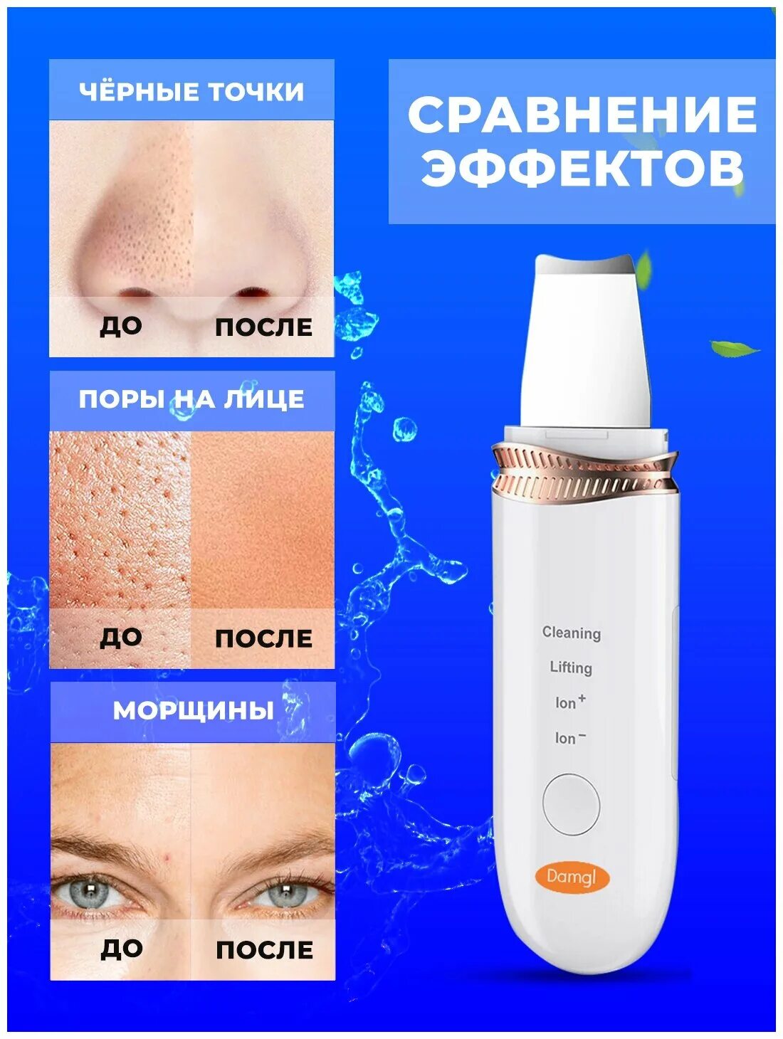 фонофорез лица протокол процедуры. фонофорез для лица отзывы. аппарат для ультразвуковой чистки лица отзывы. ионофорез для лица. фонофорез для лица отзывы.