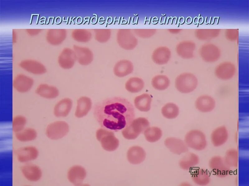 палочкоядерные нейтрофилы