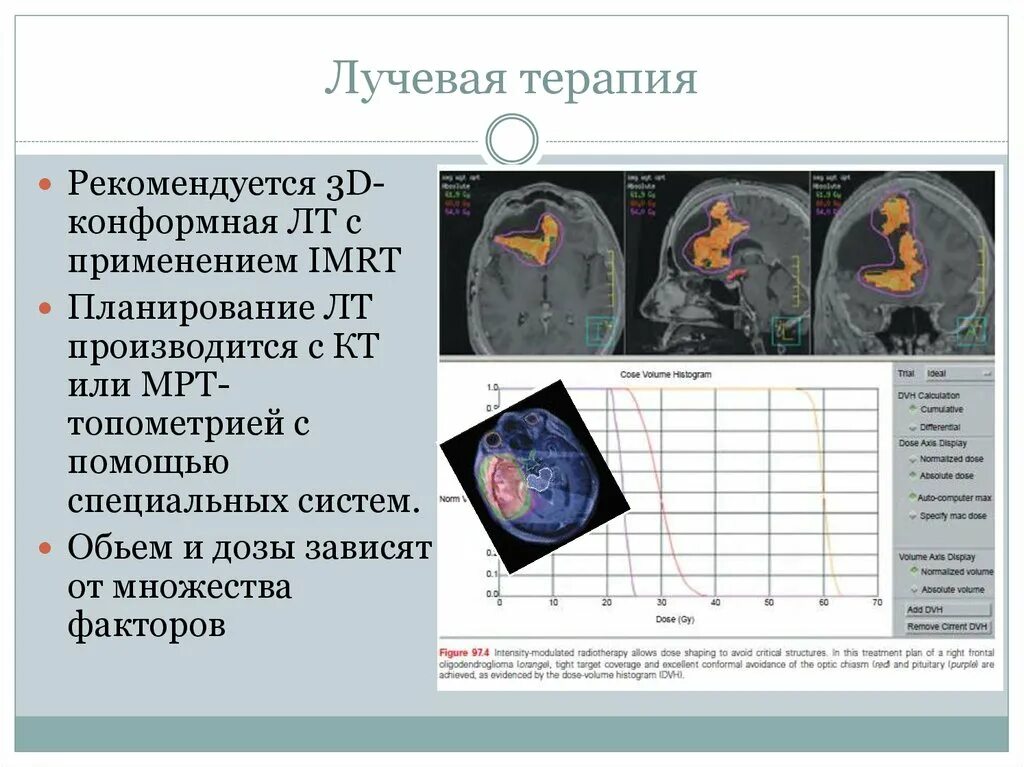 Конформная лучевая. Трехмерное планирование лучевой терапии. Клинико-дозиметрическое планирование лучевой терапии. Планирование лечения лучевой терапией. 3d планирование лучевой терапии.