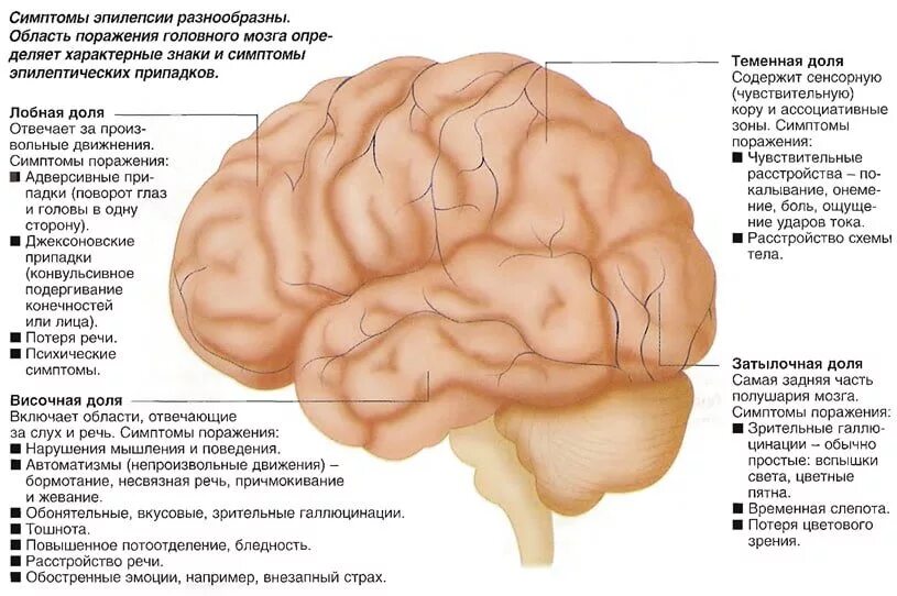 Операция при эпилепсии. Эпилепсия лобной доли симптомы. Эпилепсия очаг поражения. Очаг поражения при эпилепсии. Очаг эпилептической активности в коре головного мозга.