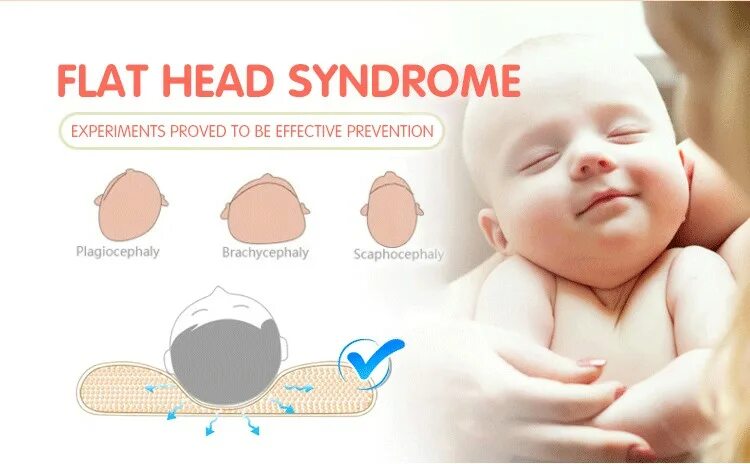 Плагиоцефалия рисунок. Форма головы новорожденного. Wedge shaped head meaning. Неправильная форма головы у ребенка. Затылочная плагиоцефалия.