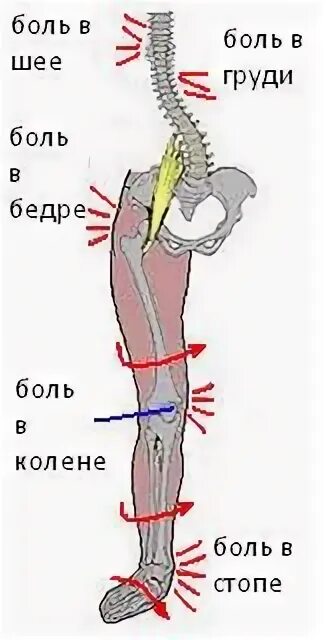 Болит нога от бедра до стопы.