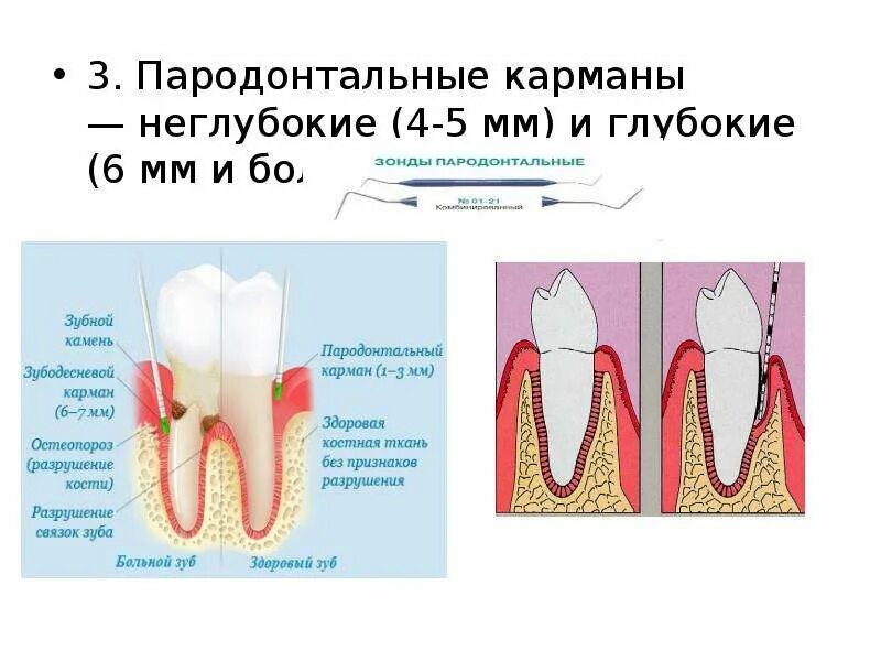 Альтернативный подход к традиционной пародонтальной хирургии (1137) - Пародонтол
