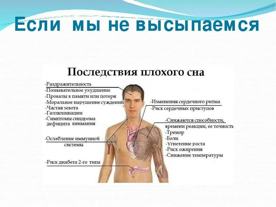 Последствия неправильного. Последствия нарушения сна. Признаки недосыпа. Хронический недосып симптомы. Причины недостатка сна.