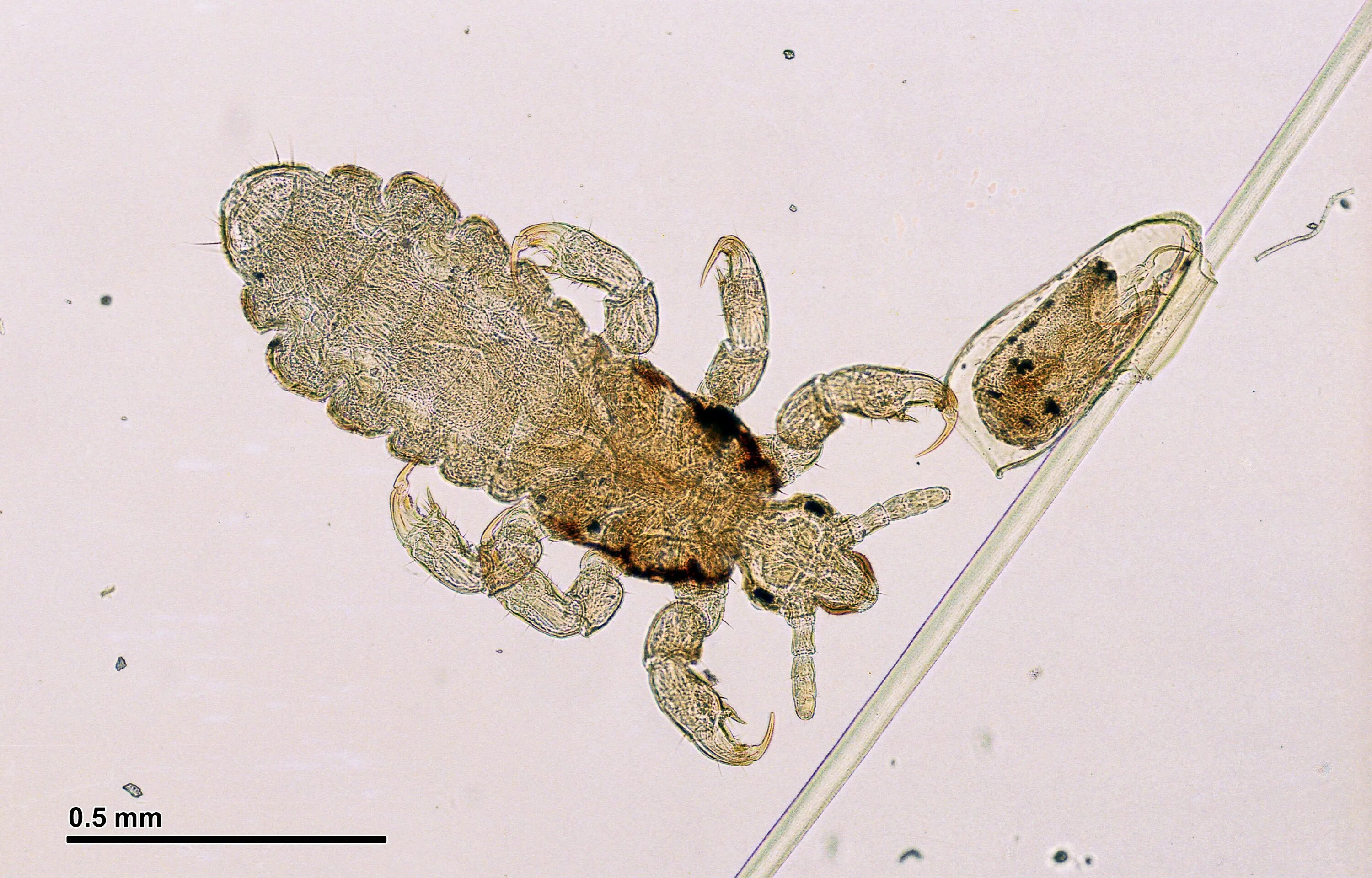 Головная вошь. Головная вошь (Pediculus humanus capitis). Микропрепарат гниды вши. Головная вошь - Pediculus capitis. Яйцо вши под микроскопом.