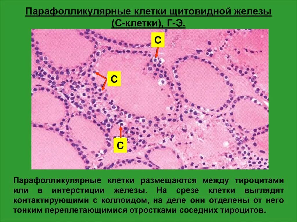 Срез щитовидной железы. Тироциты щитовидной железы гистология. Парафолликулярные клетки щитовидной железы. Парафолликулярные клетки (кальцитониноциты) щитовидной железы:. Тироциты фолликулярные клетки щитовидной железы.