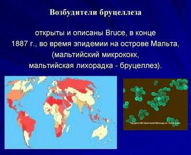 Заболеваемость бруцеллезом