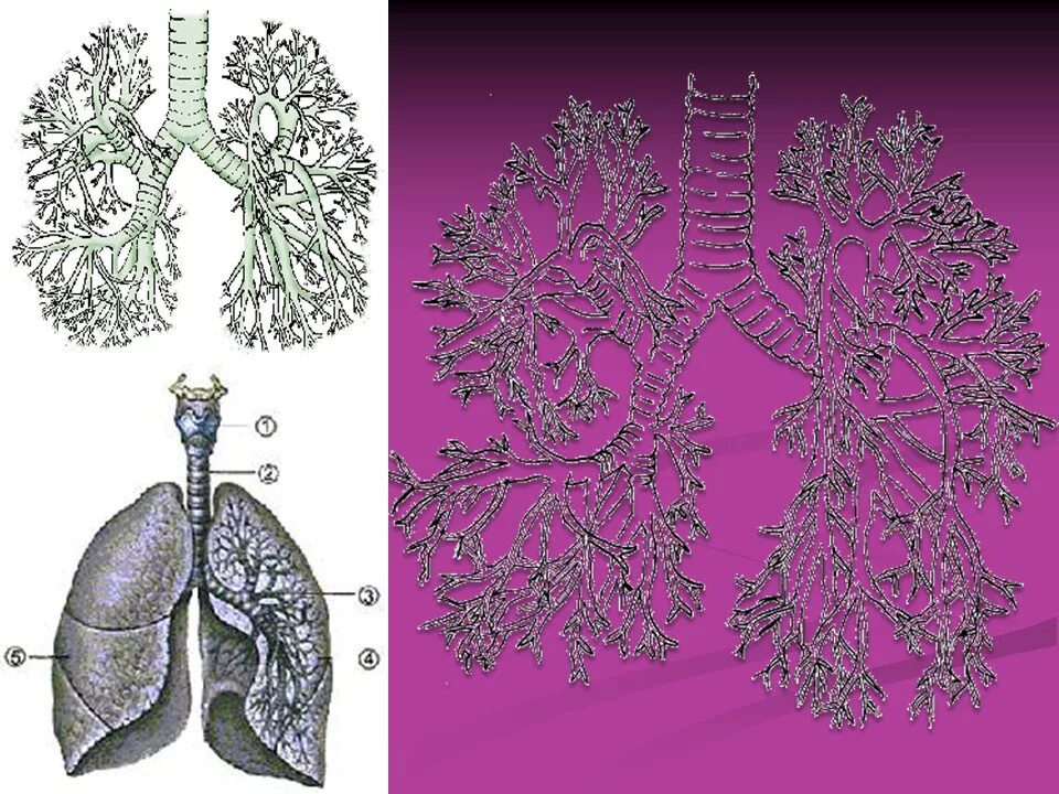 Бронхиальное дерево гистология. Выкашлял бронхиальное дерево. Эндоскопическая анатомия бронхиального дерева. Бронхи анатомия сегменты. Бронхиальное дерево легких