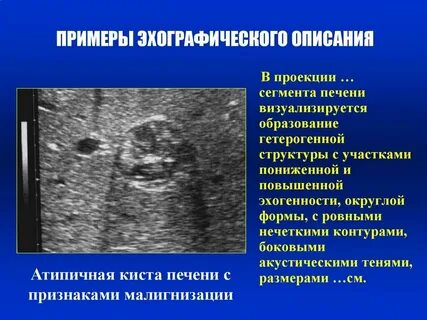 Структура поджелудочной диффузно неоднородная эхогенность повышена