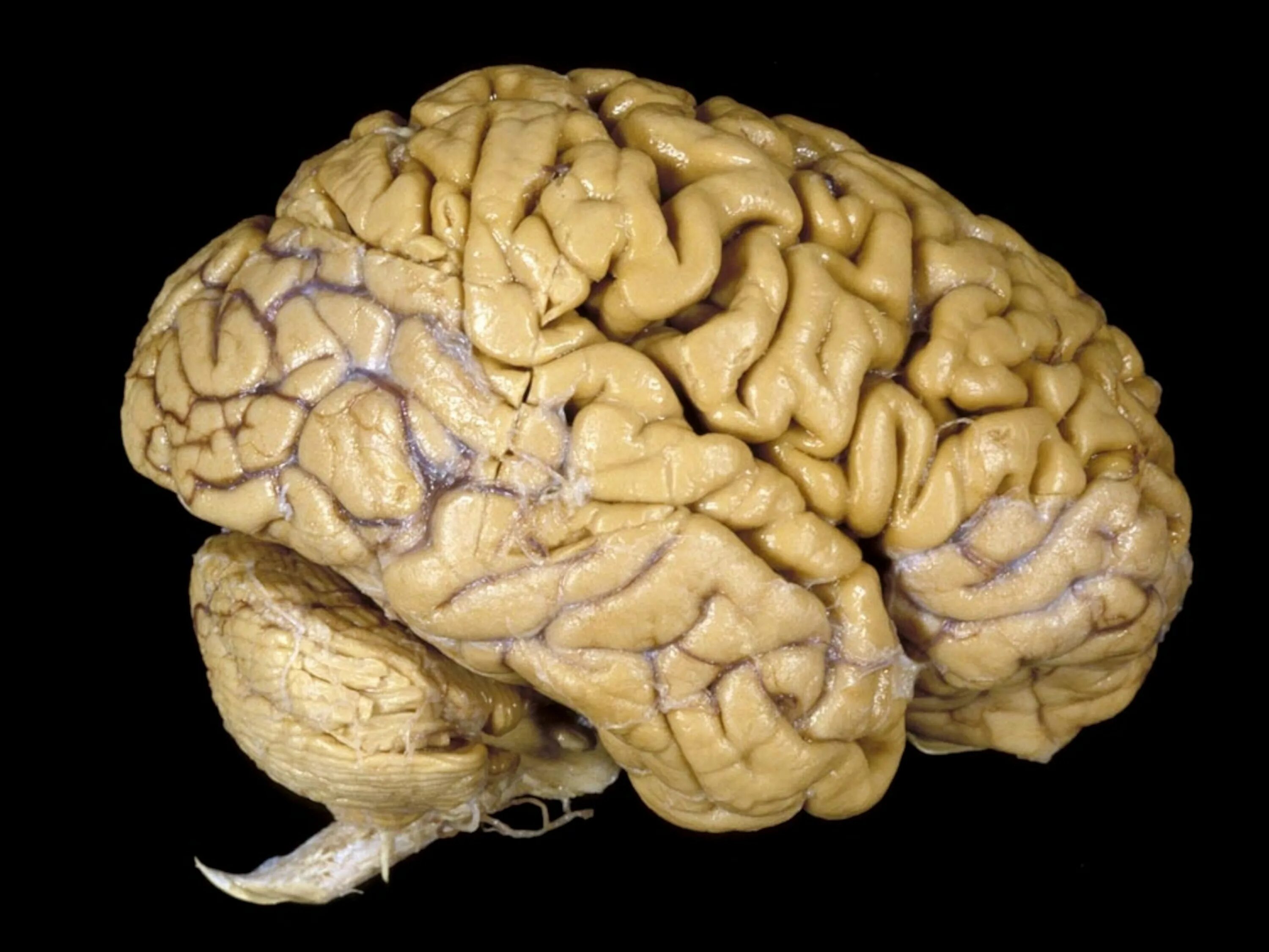 Головной мозг настоящий. Good brain