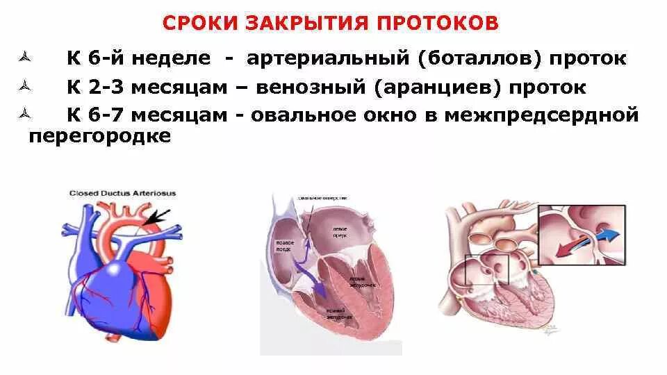 Окно в сердце у новорожденного. Окно в сердце у новорожденного