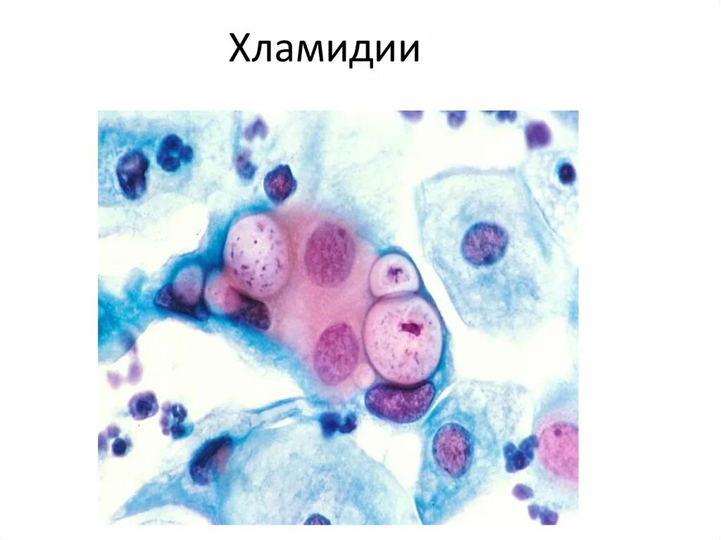 Хламидии трихомонады микоплазма. Хламидии Романовскому Гимзе. Хламидии окраска по Романовскому Гимзе. Романовский Гимза для хламидии. Chlamydia trachomatis микроскопия.