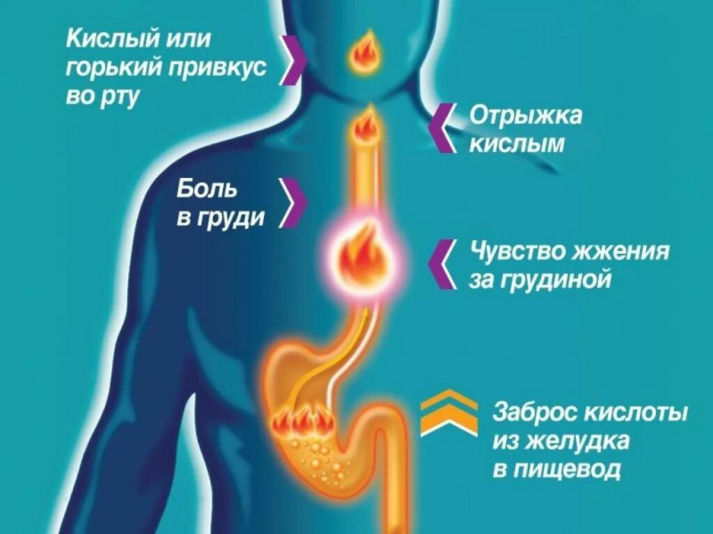 Жжение жкт