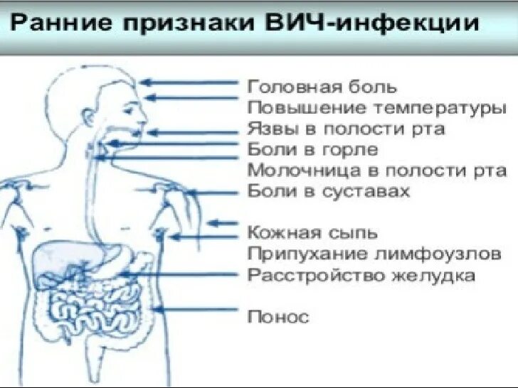 Симптомы вич через сколько. Симптомы спида вич инфекции. первые симптомы вич инфекции. 1 стадия вич инфекции симптомы. начальные симптомы вич-инфекции – это:.