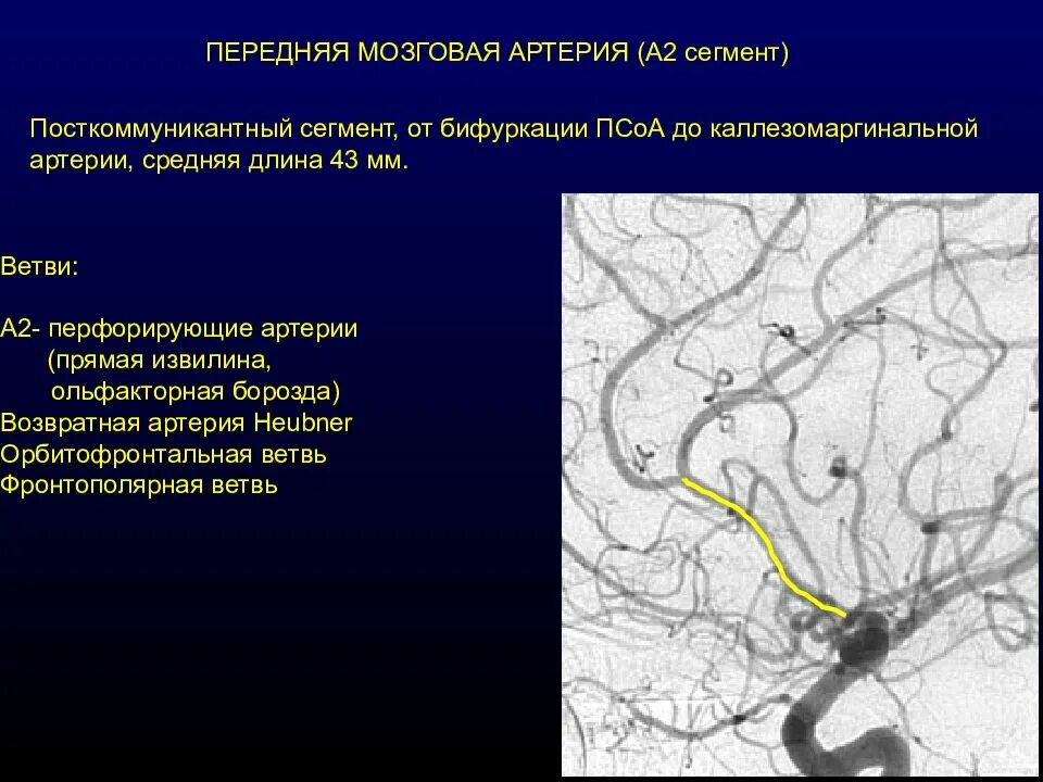Сегменты передней мозговой артерии. Средняя мозговая артерия. Сегменты средней мозговой артерии. Сосуды головного мозга анатомия. Сегмент а1 пма