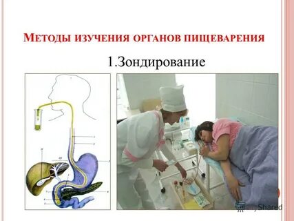Что такое зондирование