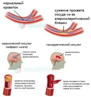 Расширение сосудов вызывают