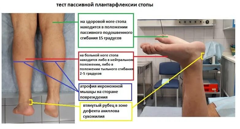 Вылечил ноги форум