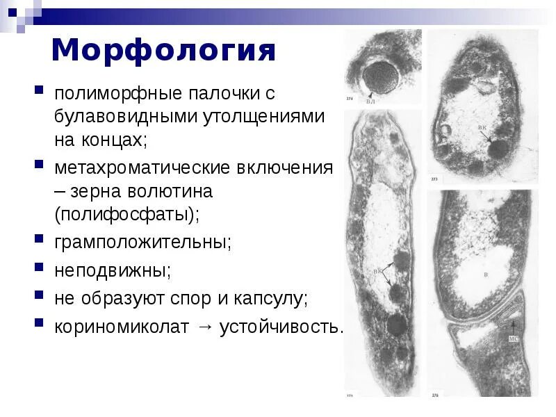 Полиморфные бактерии. Палочки дедерлейна микроскопия. Полиморфная палочка. Полиморфные палочки что это такое. Грамотрицательные изогнутые палочки.