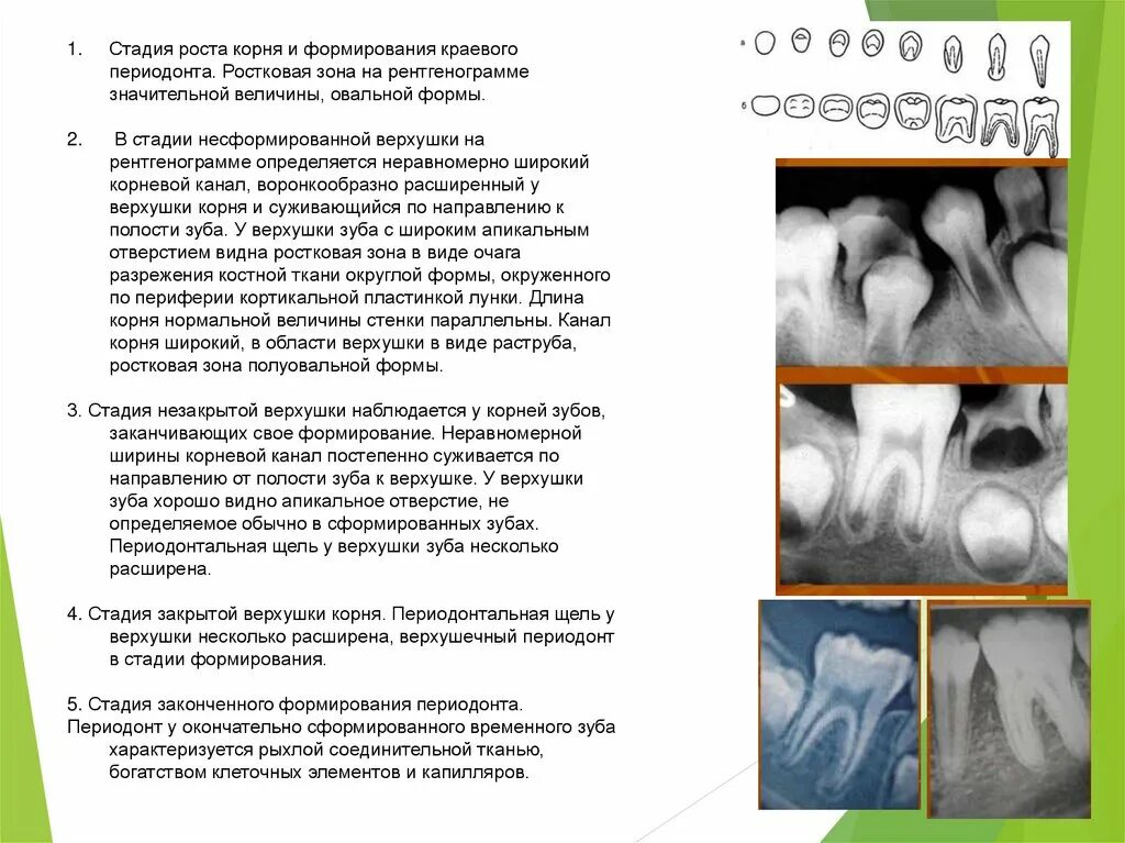 Верхушечный рост корня. Фазы формирования корня постоянного зуба. Стадии формирования верхушки корня зуба. Стадия формирования корня зуба рентгенограмма. Стадии развития корня постоянного зуба.