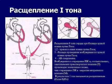 Нарушение проведения гиса