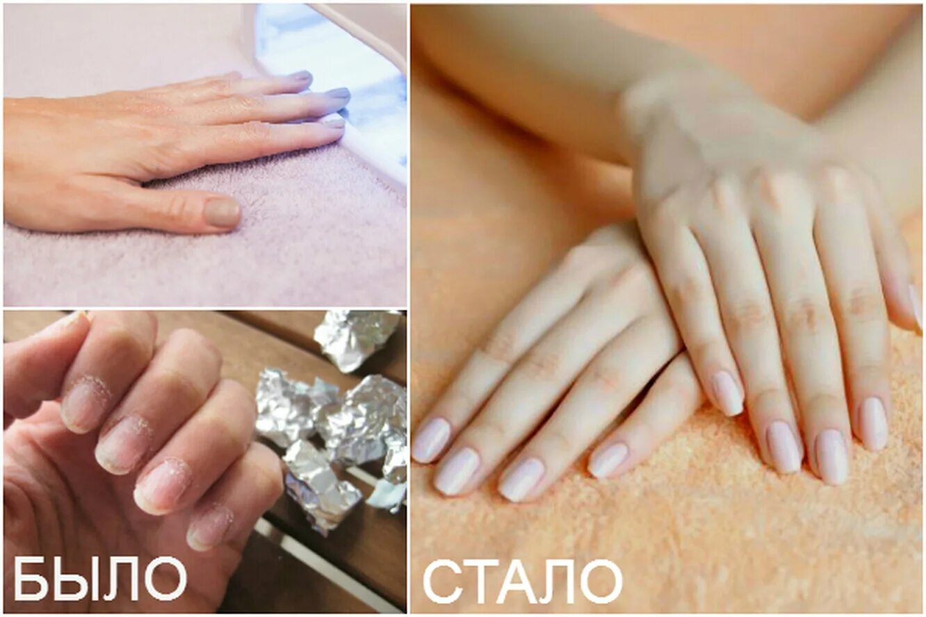 После снятия шеллака. Можно сделать маникюр без обезжиривателя. После снятия шеллака. Ногти после шеллака ужасные. Страшные ногти после гель лака.