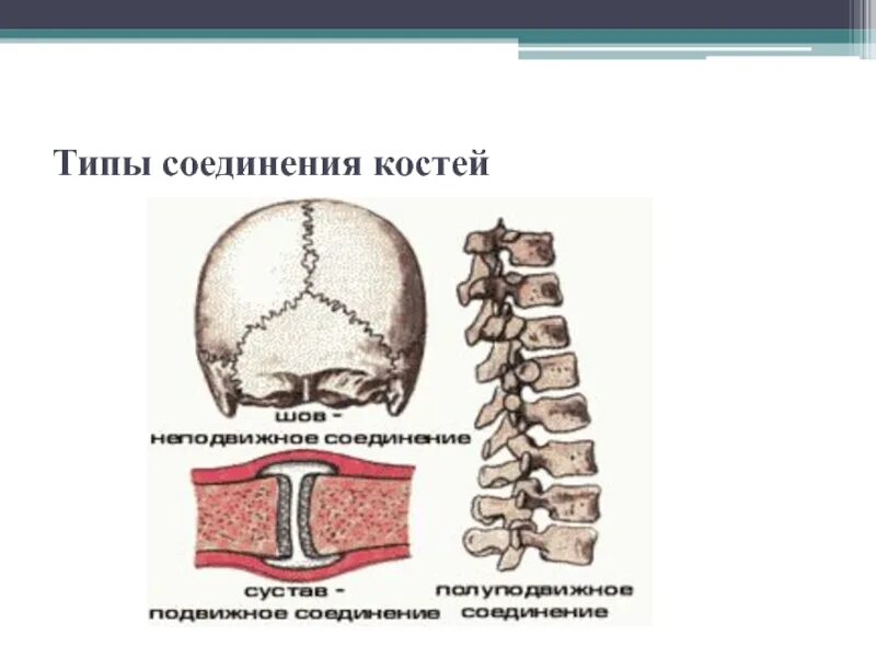 Определите тип соединения костей кости черепа позвонки. Подвижное полуподвижное и неподвижное соединение костей. полуподвижное соединение костей строение. неподвижные полуподвижные и подвижные соединения костей. подвижная полуподвижная неподвижная соединение костей.