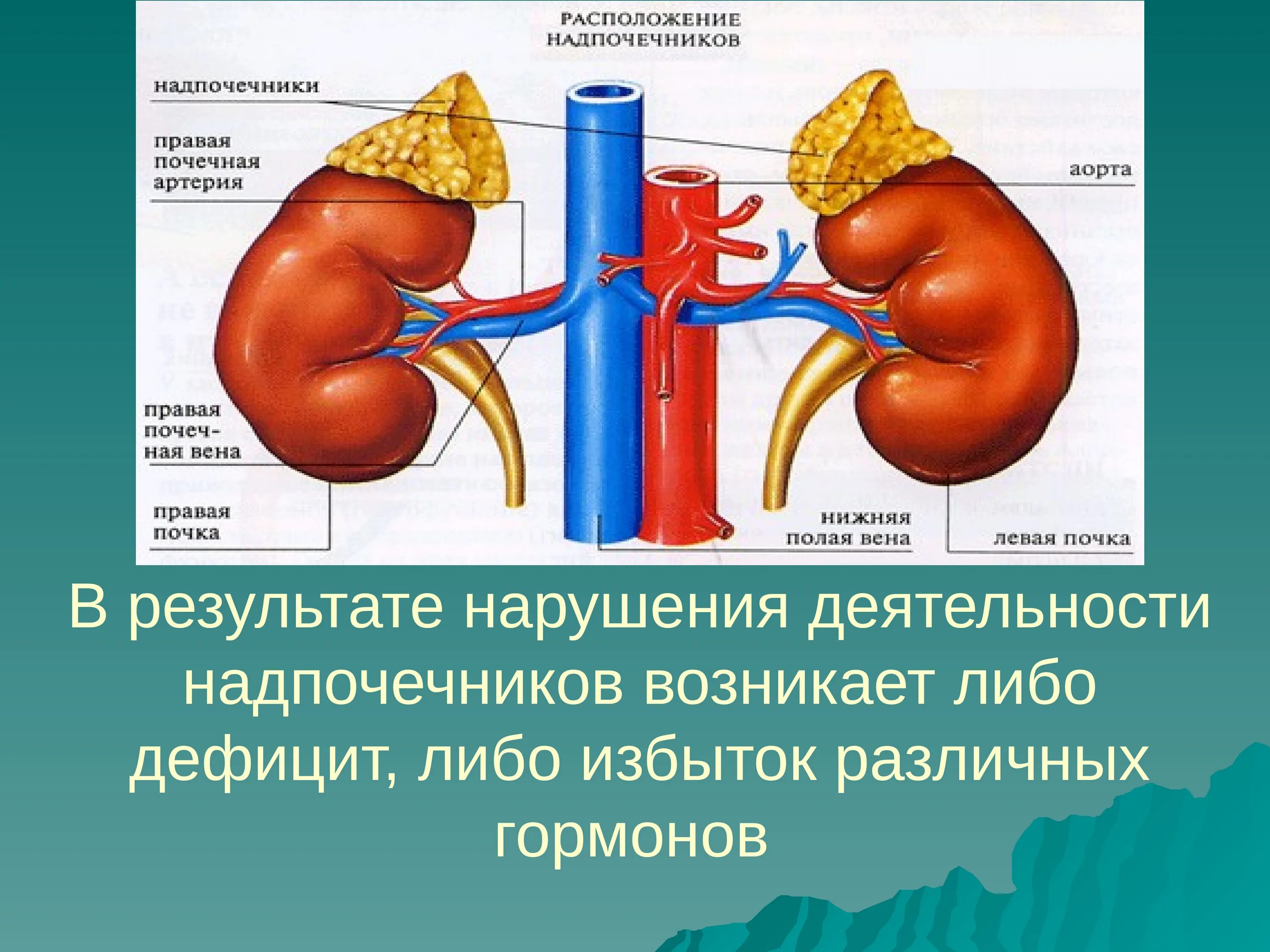 Какие заболевания надпочечников. Почки и надпочечники. Надпочечники местоположение. Почки и надпочечники расположение. Правый и левый надпочечники.