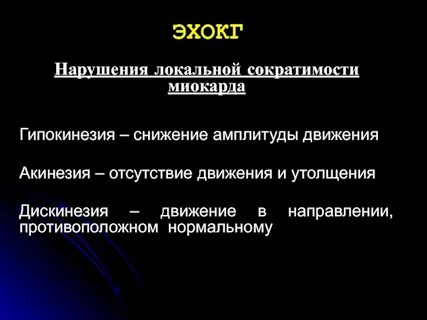 Гипокинез