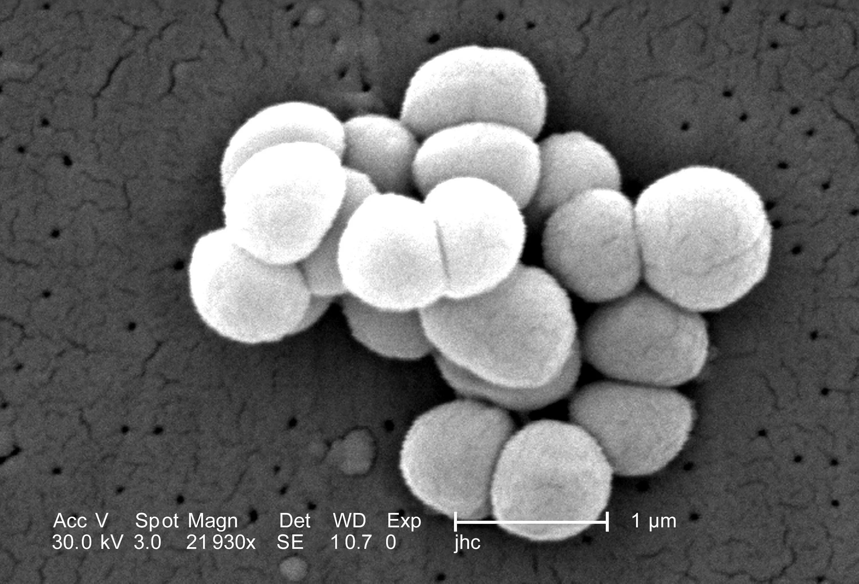 Micrococcus Agilis в микроскопе. Кокки микрококки. Micrococcus flavus. Шаровидные микрококки. Rothia mucilaginosa