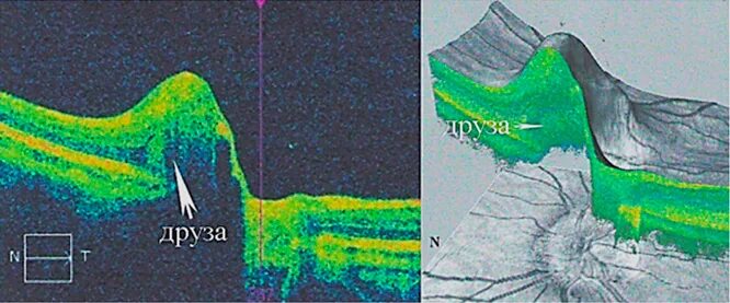 слои сетчатки по ост. оптическая когерентная томография слизистой полости рта. оптическая когерентная томография (ост) зрительного нерва. оптическая когерентная томография сетчатки. где можно сделать окт.