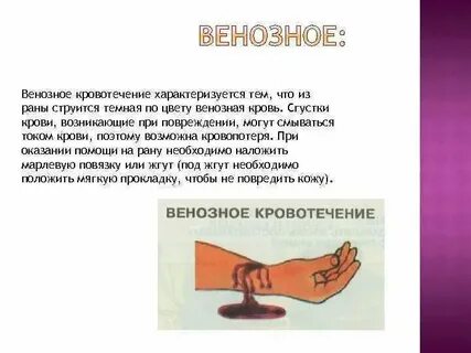Варикозное кровотечение желудка