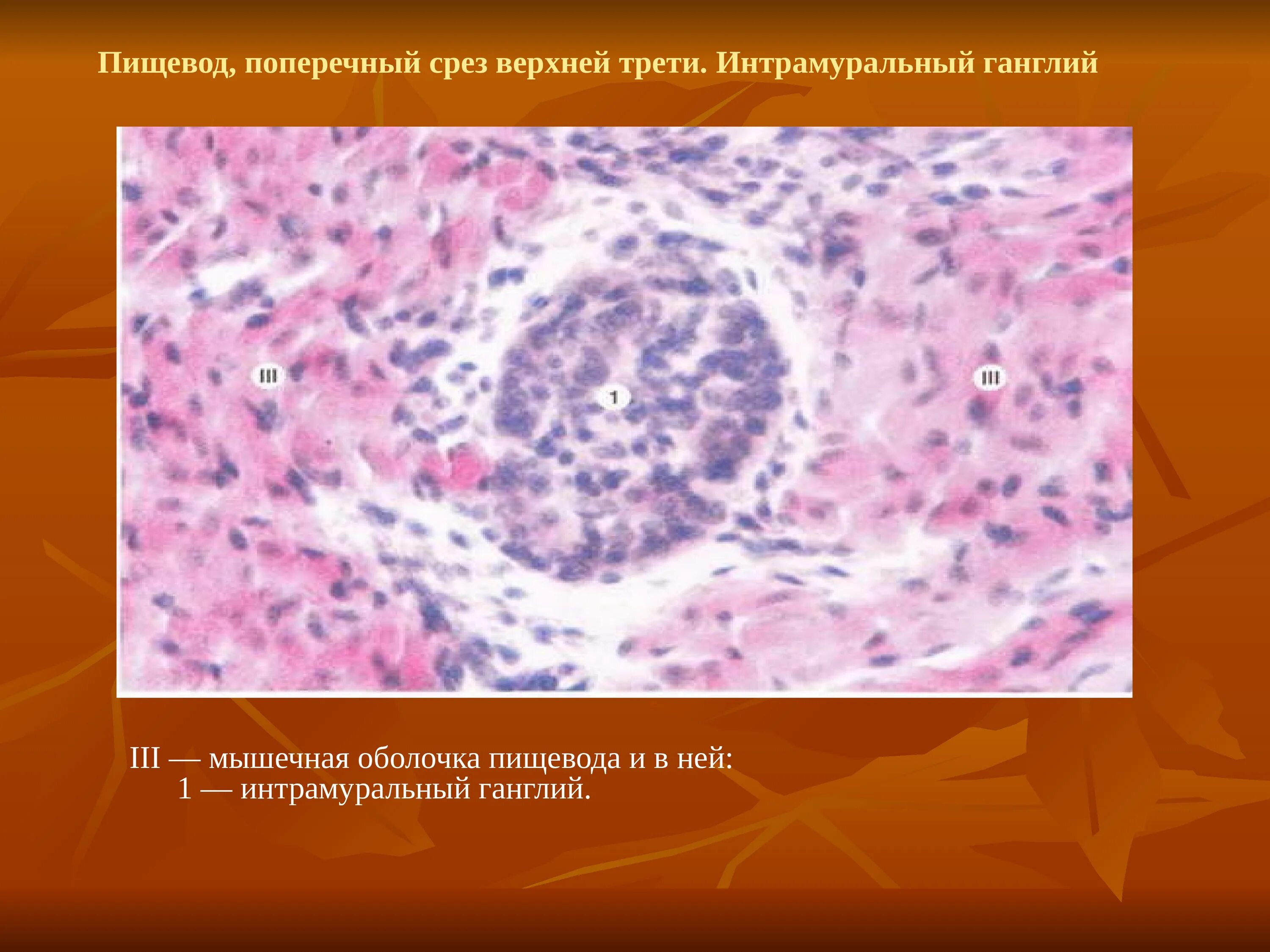 Сателлиты гистология. Интрамуральные узлы это гистология. интрамуральные ганглии препарат. интрамуральные ганглии гистология. интрамуральный ганглий гистология препарат.
