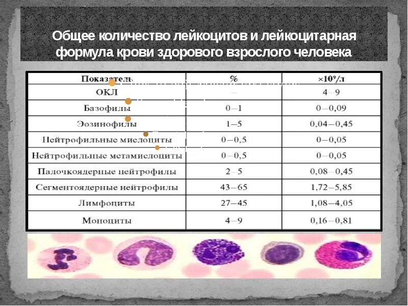 Возрастные нормы лейкоцитарной формулы. Лейкоцитарная формула лимфоциты моноциты. Лейкоцитарная формула лимфоциты 50. Норма лейкоцитов в лейкоцитарной формуле.