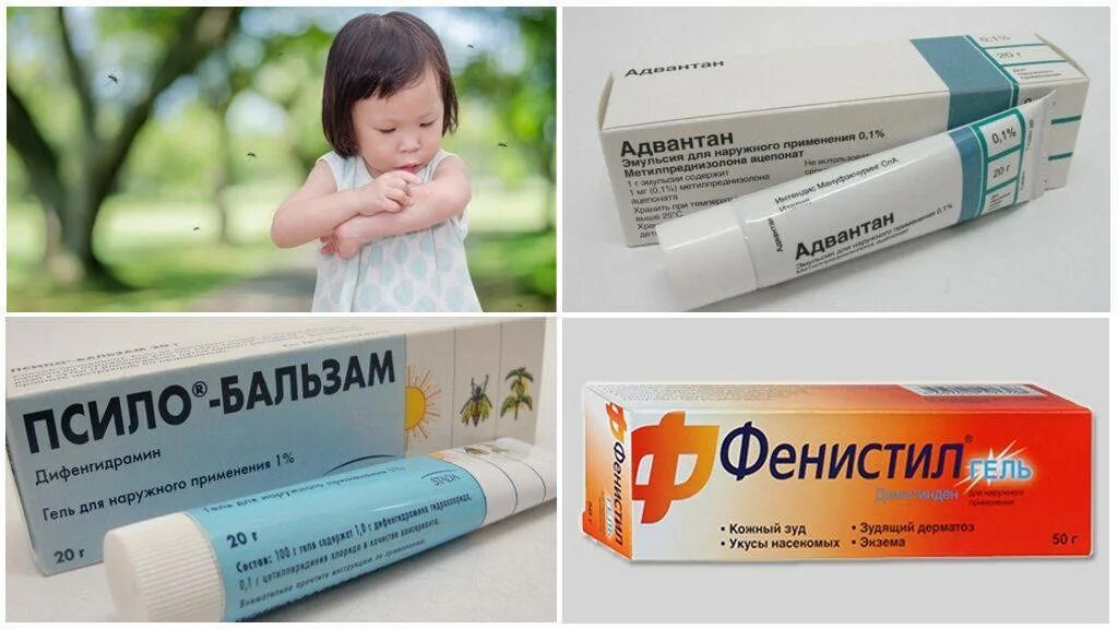 Как быстро снять зуд у ребенка. Мазь от аллергии для детей. гель от зуда кожи детский. детская мазь от аллергии на коже. противоаллергические мази для детей.