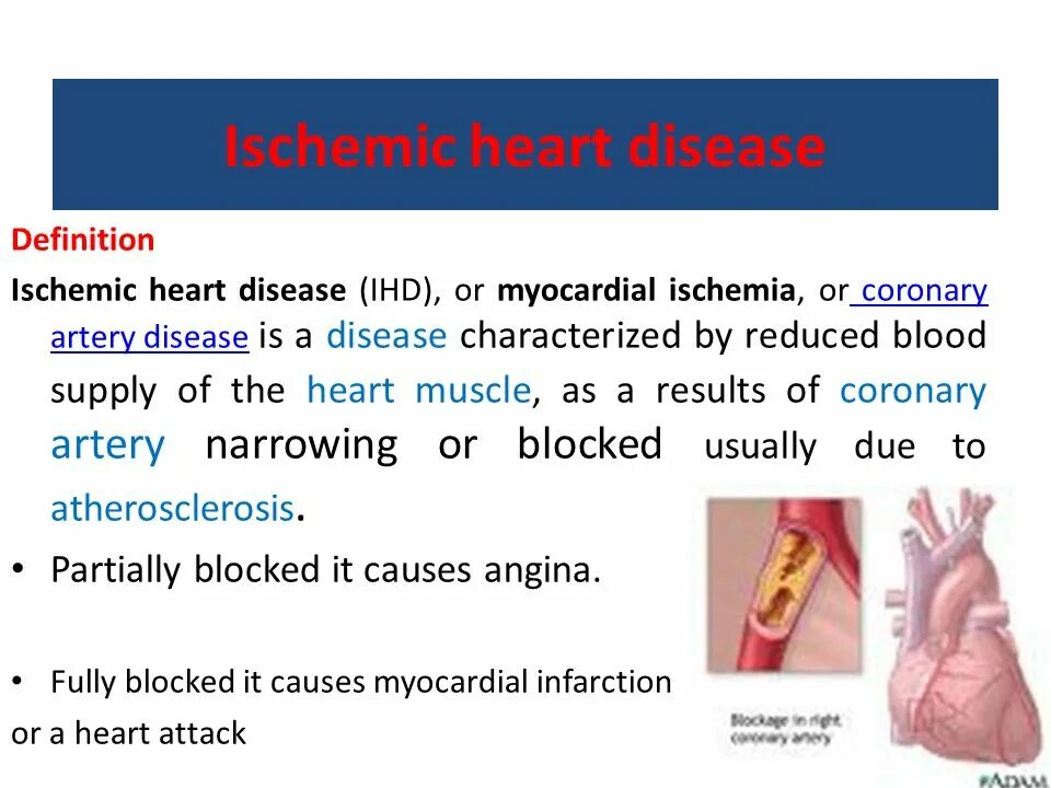 Heart disease causes. Heart disease causes. Heart disease and diabetes. Заболевания сердца на английском. Heart disease causes.