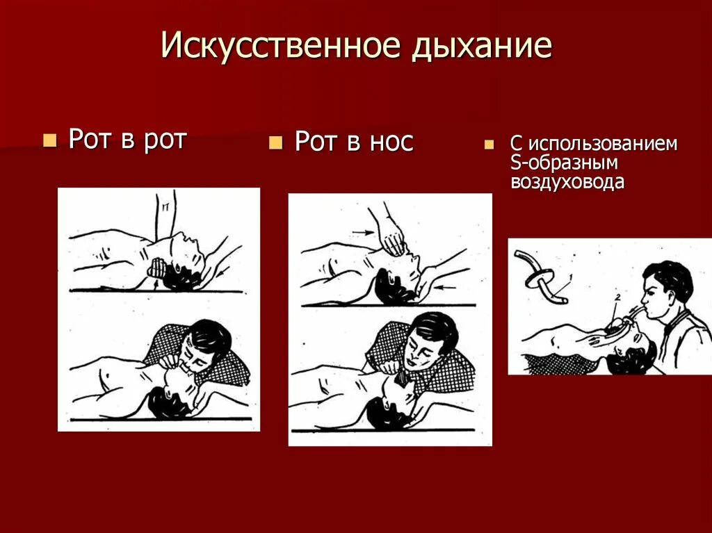 2 способа искусственного дыхания