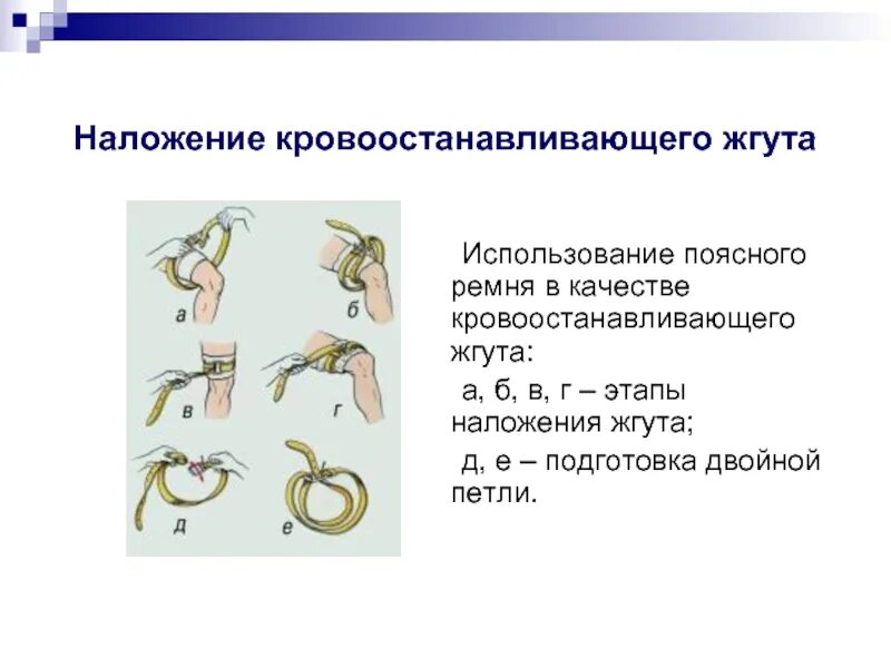 Техника кровоостанавливающего жгута предусматривает ответ. Наложение кровоостанавливающего жгута. использование поясного ремня в качестве кровоостанавливающего жгута. этапы наложения кровоостанавливающего жгута. жгут кровоостанавливающий.