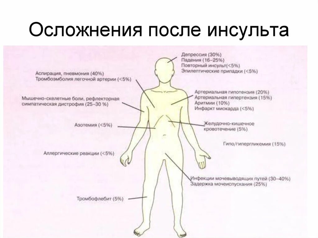 Последствия инсульта могут быть. Осложнения инсульта. Постинсультные осложнения. Последствия и осложнения после инсульта. Нарушения после инсульта.