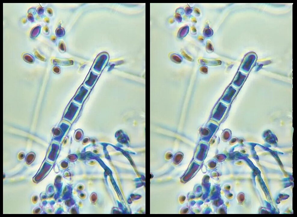 Микроскопия trichophyton rubrum. Trichophyton schoenleinii морфология. Trichophyton schoenleinii морфология. Trichophyton verrucosum. Гриб трихофитон.