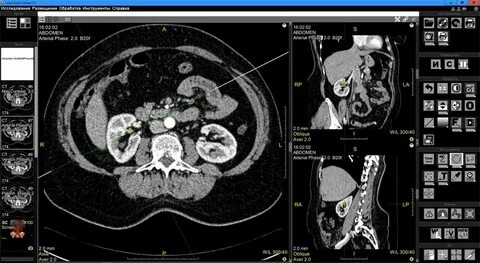 Cdviewer