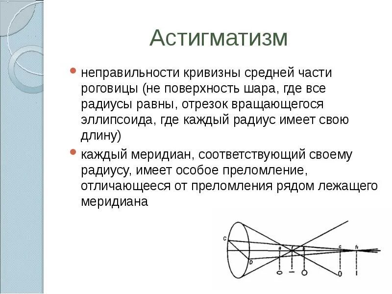 Астигматизм что это и как лечить. Радиус кривизны линзы физика. астигматизм физика. астигматизм рефракция. рефракция глаза это.
