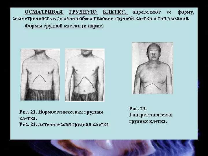 Пауза грудной клетки. Бронхиальное дыхание аускультация. Окружность грудной клетки на вдохе и выдохе. Грудная клетка. Пауза грудной клетки.